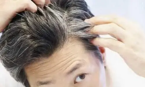 白头发是缺少什么微量元素