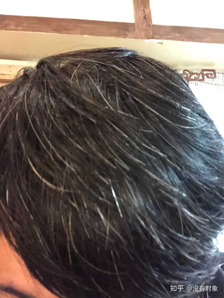 补硒能改善白发