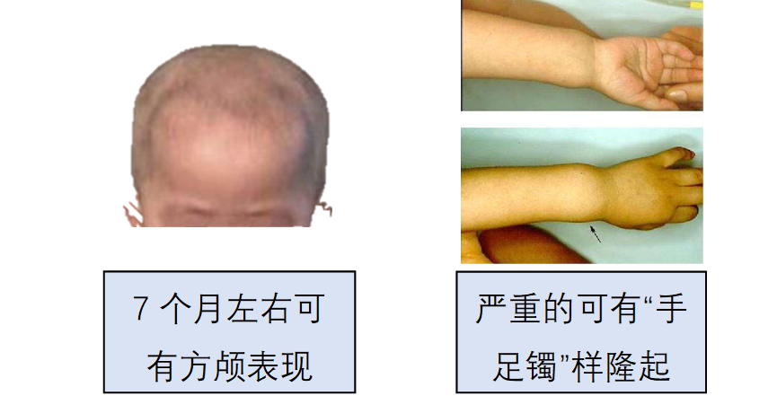婴儿需要补锌吗