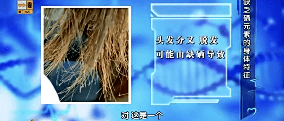 有机硒片补硒吗