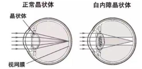 补硒后眼睛亮了