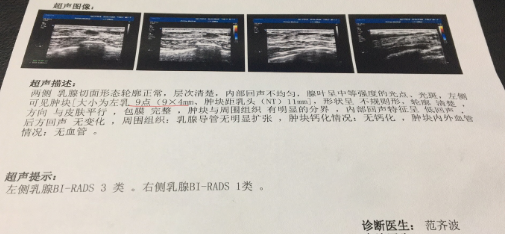 乳腺结节要补硒