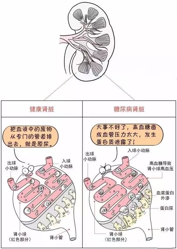 补硒预防脑出血