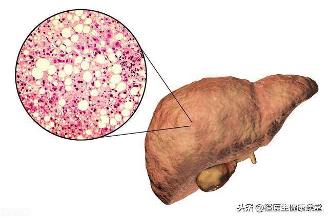 补硒后肝区疼痛