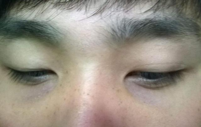 胃不好，脸上马上出现这3个症状，一招就让你调理好