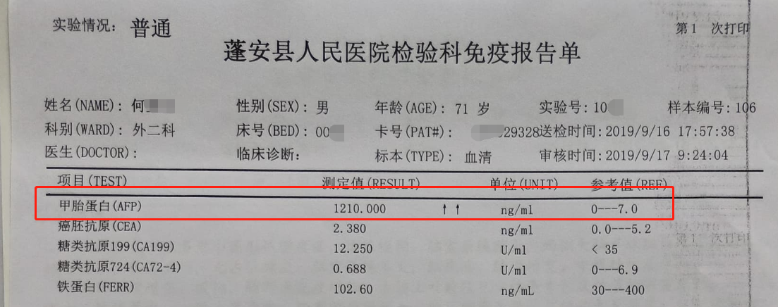 甲胎蛋白高补硒
