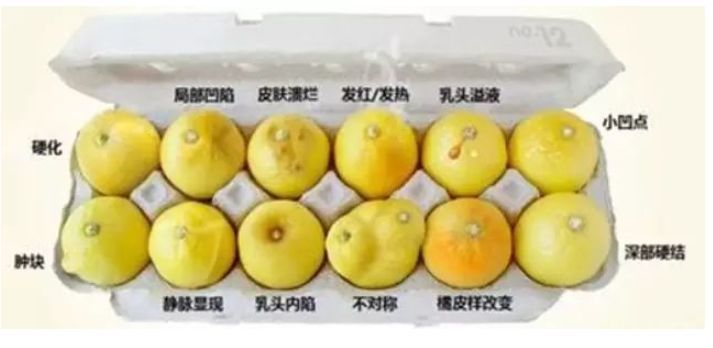乳腺癌如何补硒