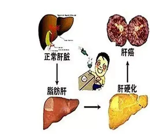肝中毒能补硒吗