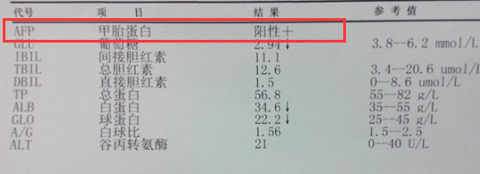 有肝炎能补硒吗