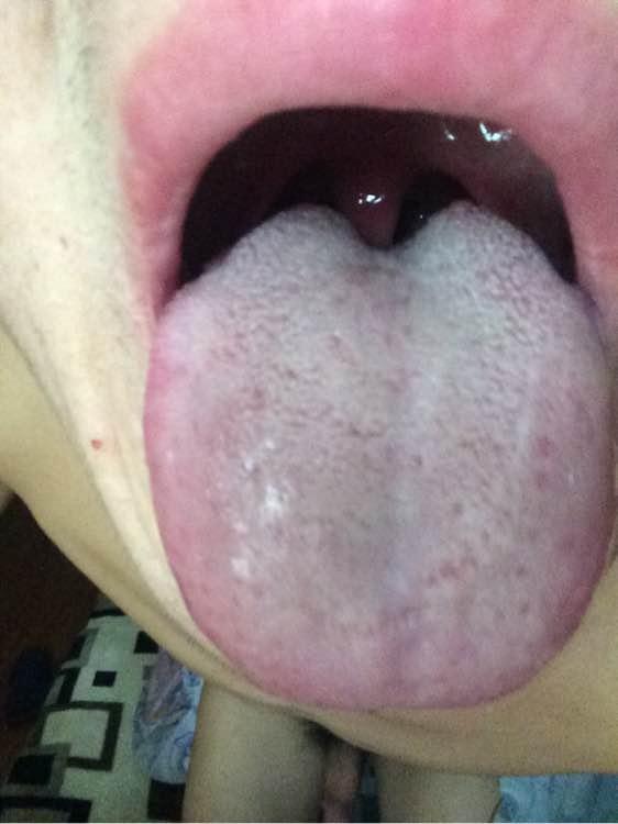 硒吃什么药能补