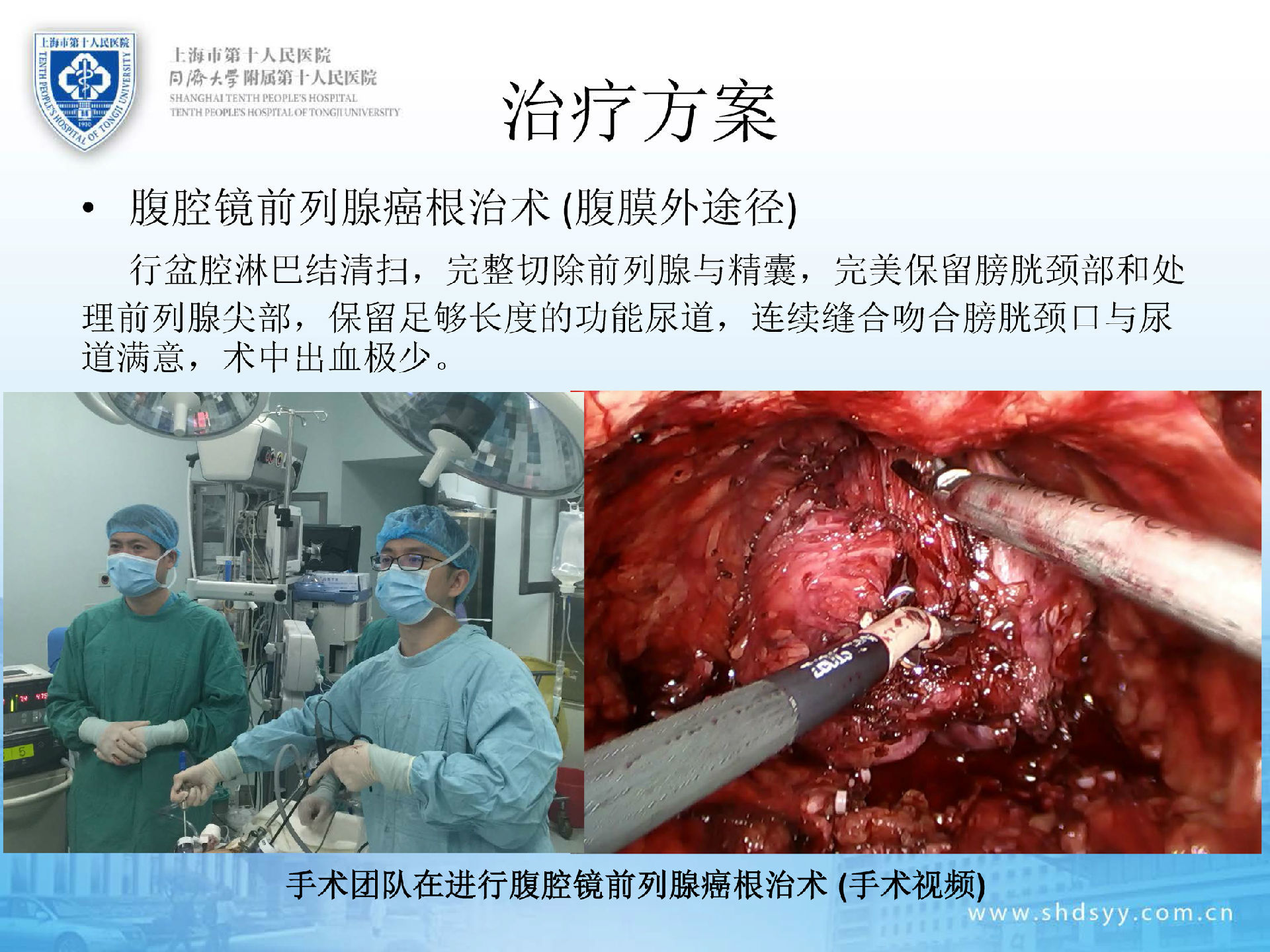 补硒与前列腺癌