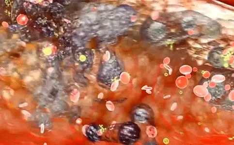 藤匠人富硒莓茶