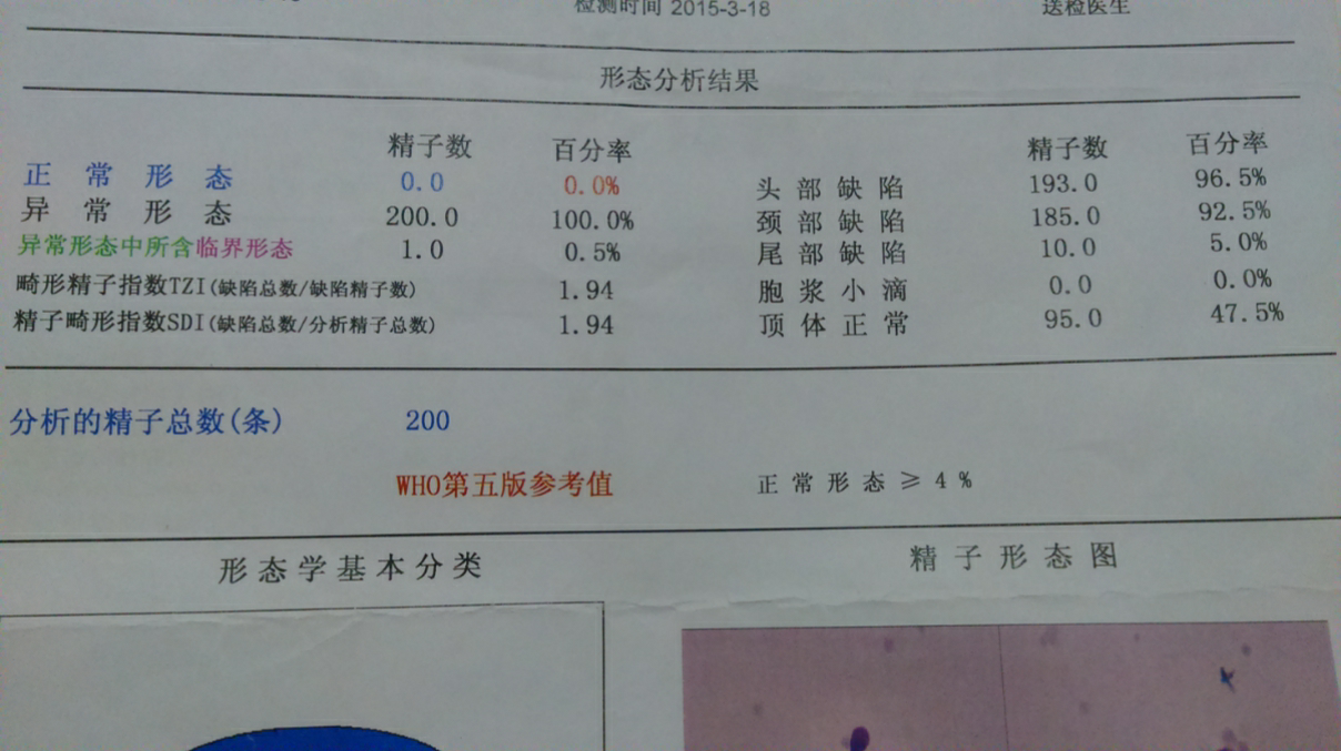 哪个牌子锌硒宝