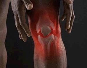 类风湿需要补硒吗