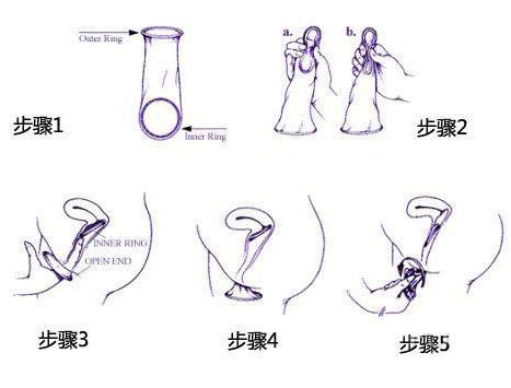补硒能否提高性功能
