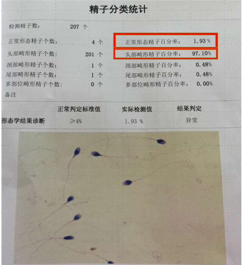 备孕男士锌硒宝