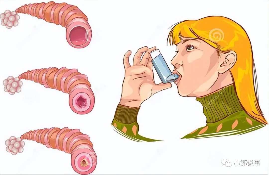 硒酵母是补硒的吗