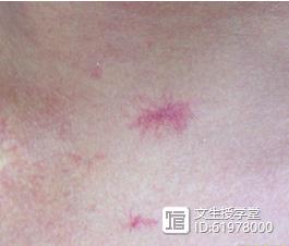 硒麦芽补硒解毒素