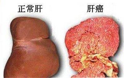缺硒人群怎么补硒