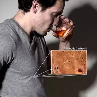 转氨酶高能补硒吗
