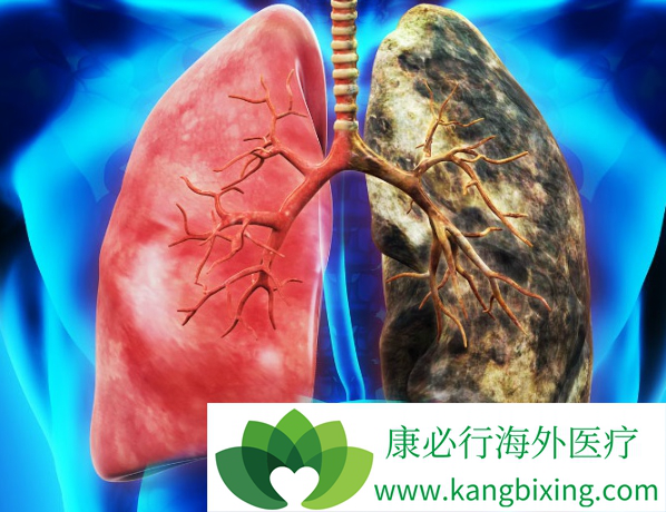 肺癌患者补哪种硒