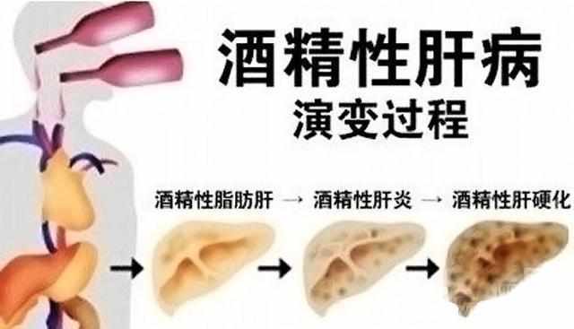 补硒过量导致耳鸣