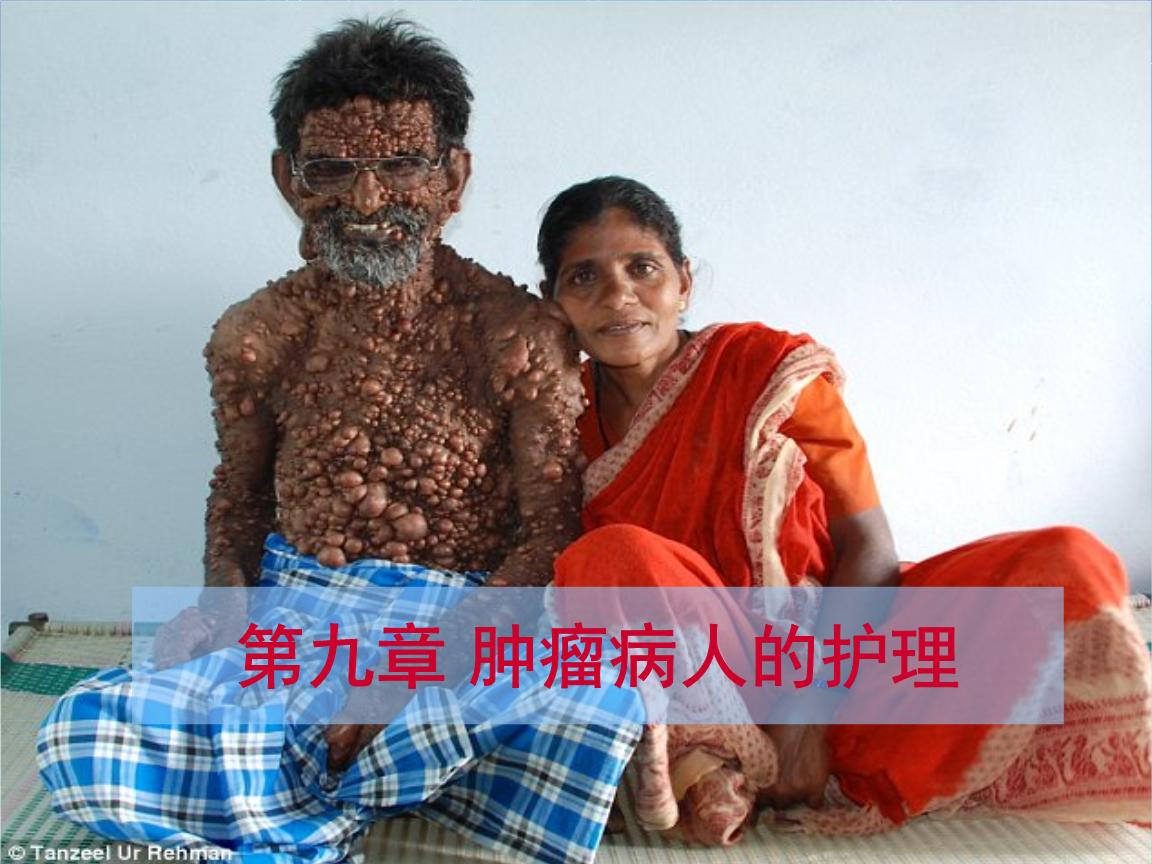 喉癌患者可补硒吗