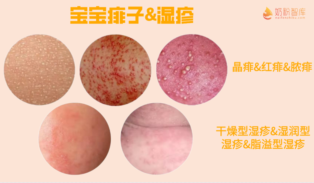 硒补多了会起疹子