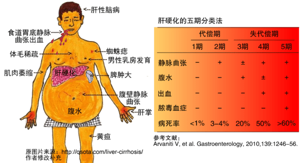 肝病为什么要补硒