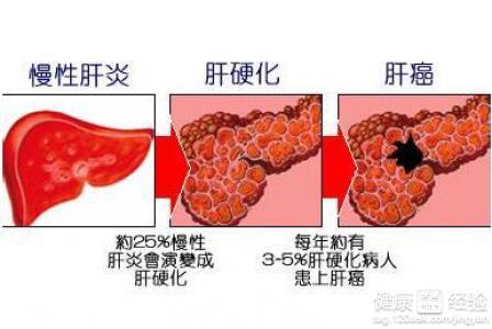 乙肝病人怎么补硒