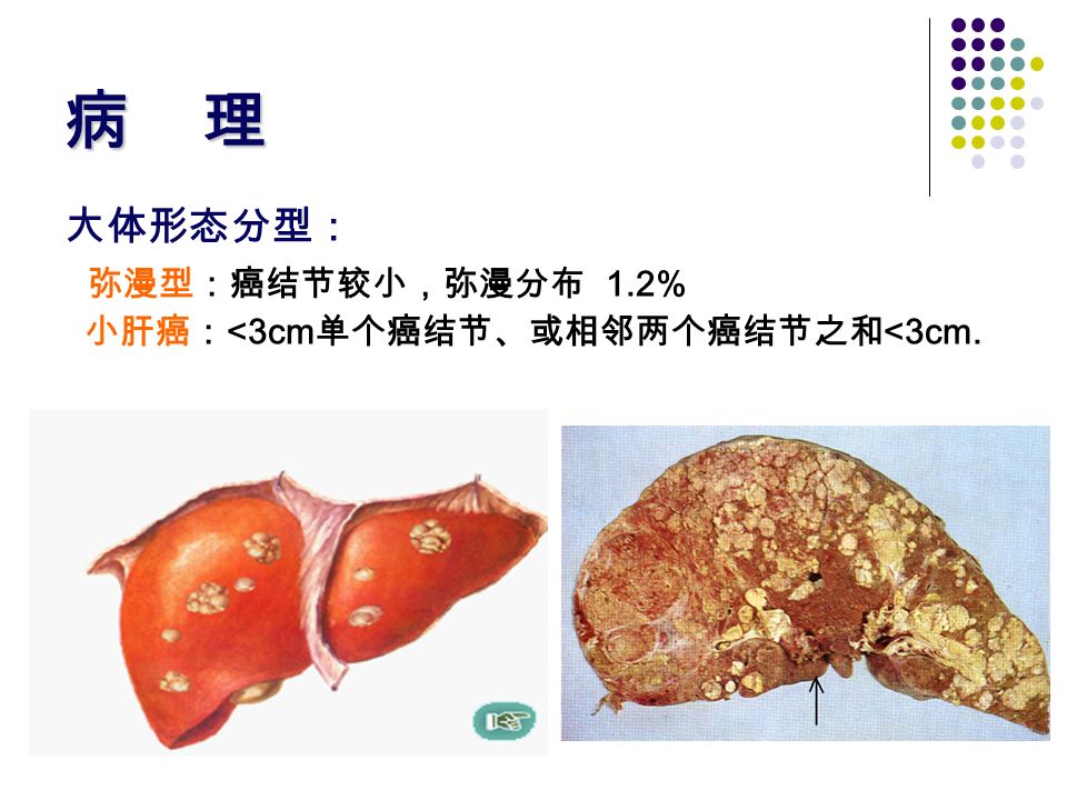 乙肝患者怎样补硒