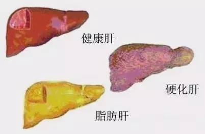 脑肿瘤需要补硒吗