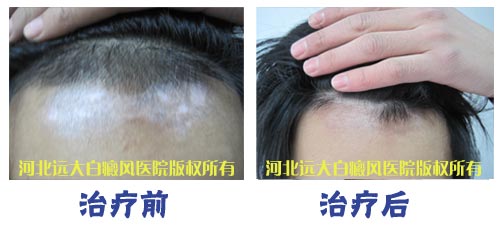 治疗