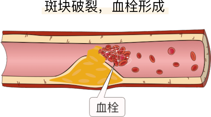 补硒的功效和坏处
