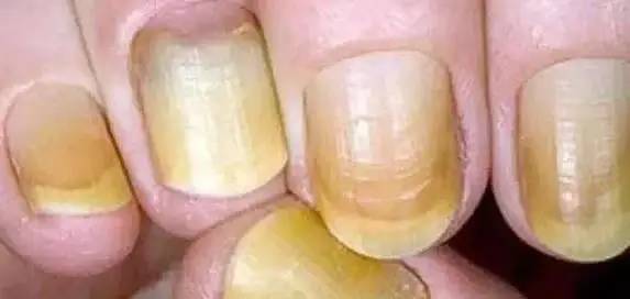 肝脏不好要补硒吗