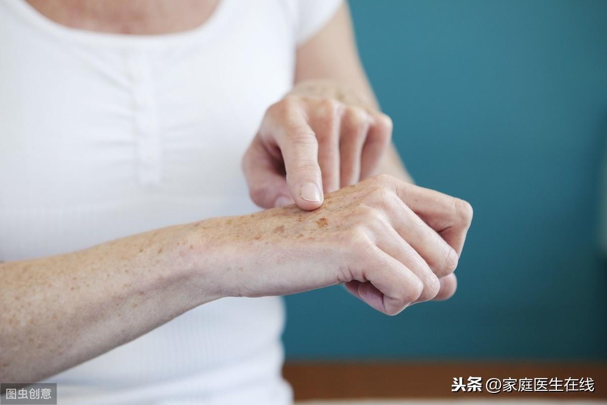 补硒能去老年斑吗