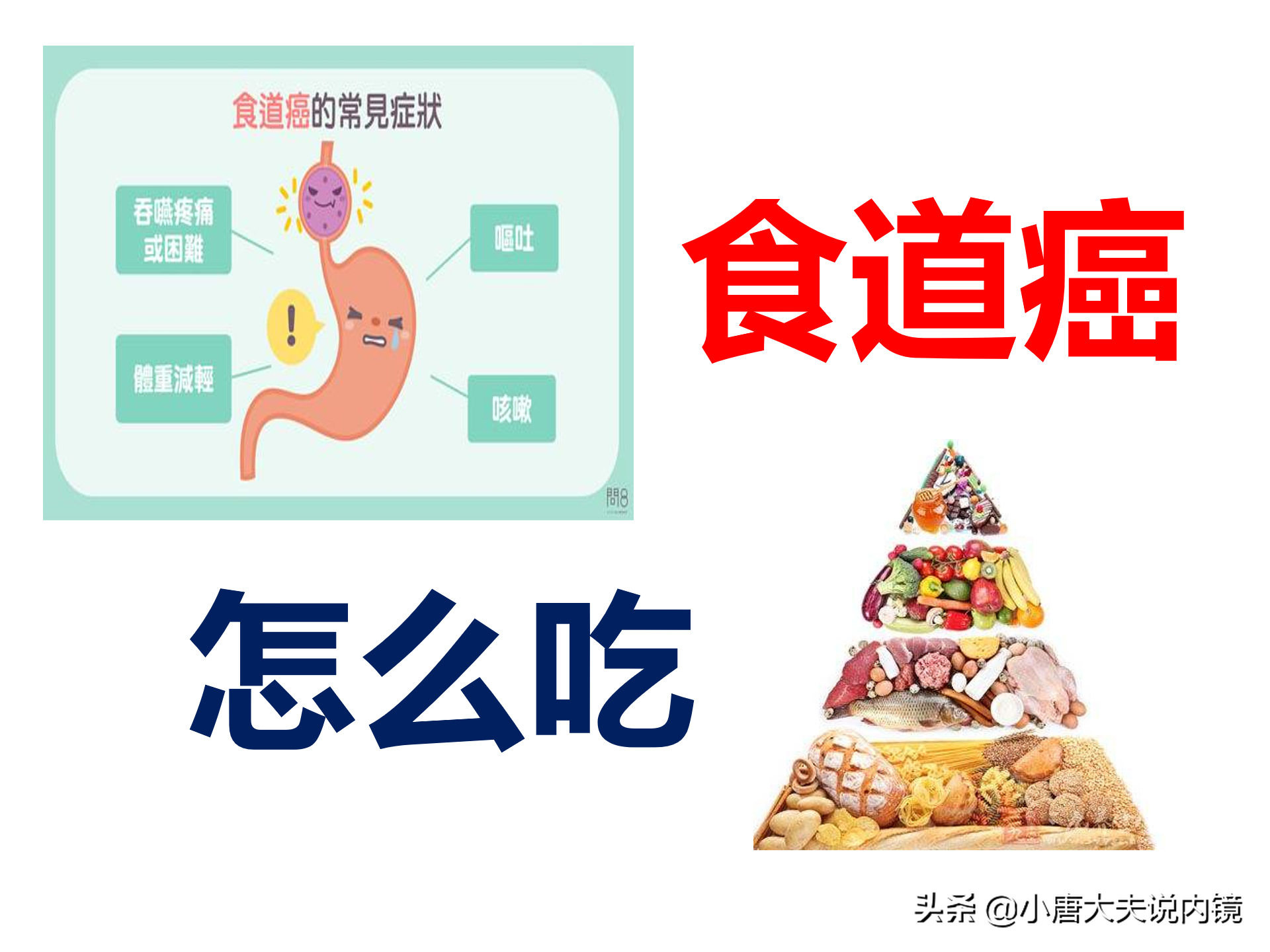食道癌补硒能好吗