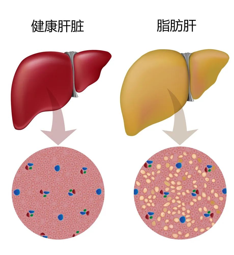 肝脏需不需要补硒