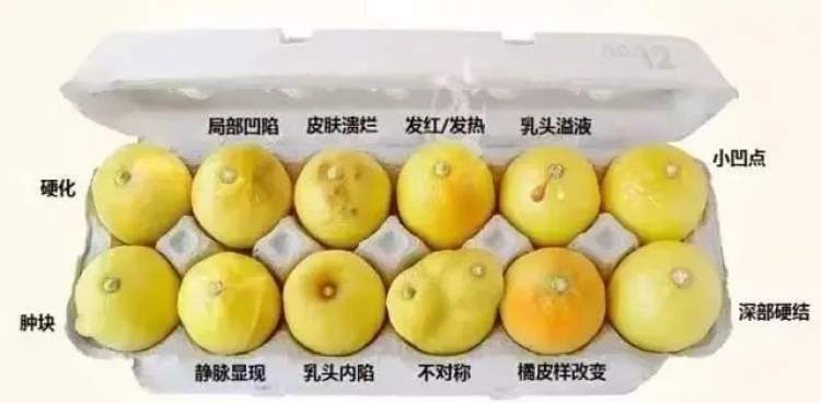 乳腺癌补什么硒好