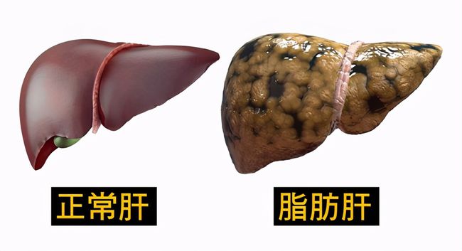补锌补硒的药伤肝
