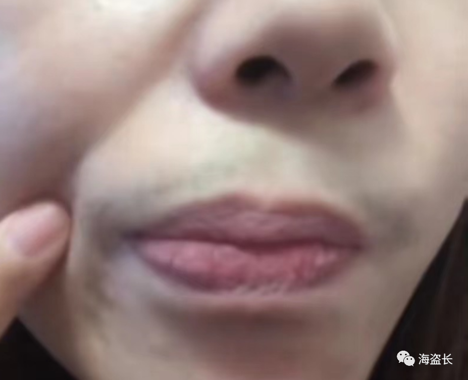 补硒提高雄性激素