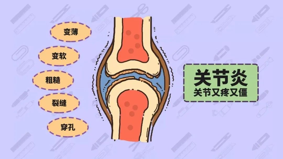 类风湿病要补硒吗