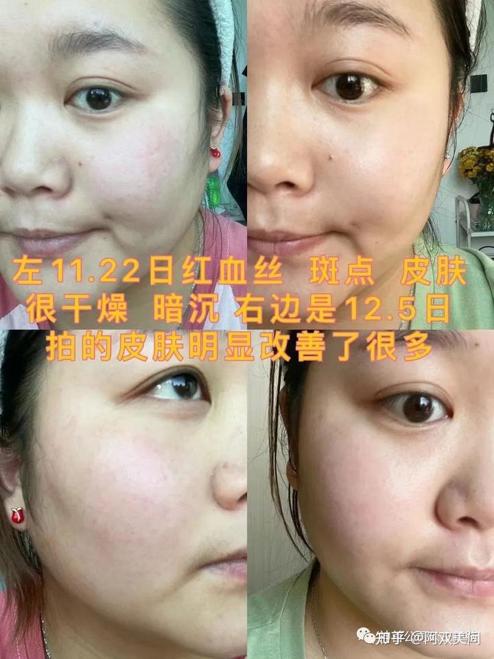 硒硒公主美容产品