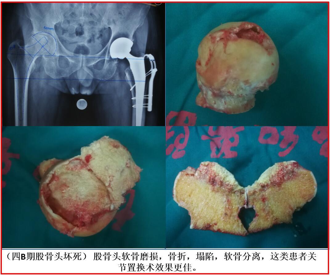 硒产品的销售模式