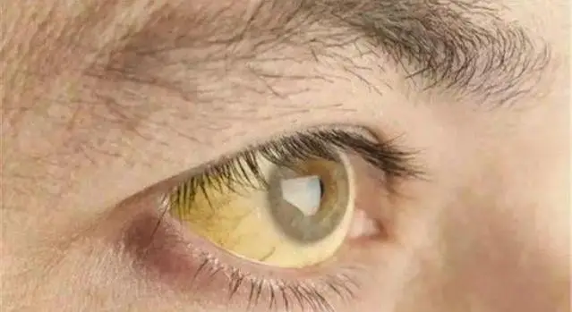 缺乏微量元素怎么补