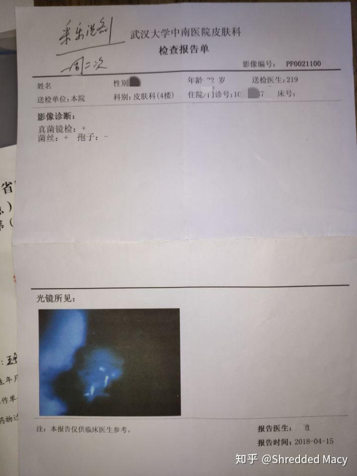 硒产品能治布病吗