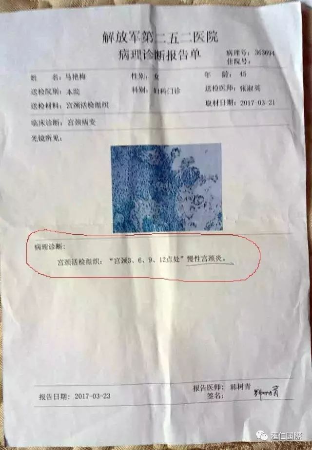 奥希维康是有机硒