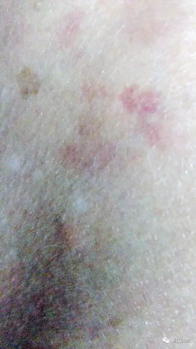 奥希维康是有机硒