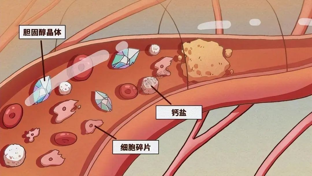 男人补钙吃什么钙片好