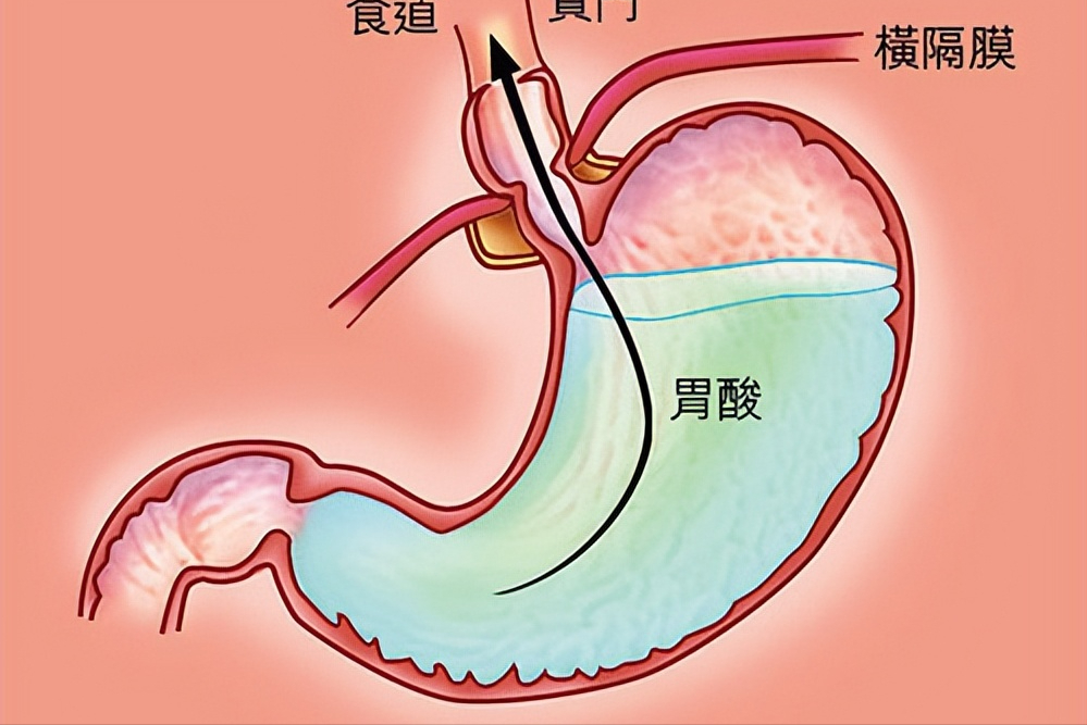 男人补钙吃什么钙片好